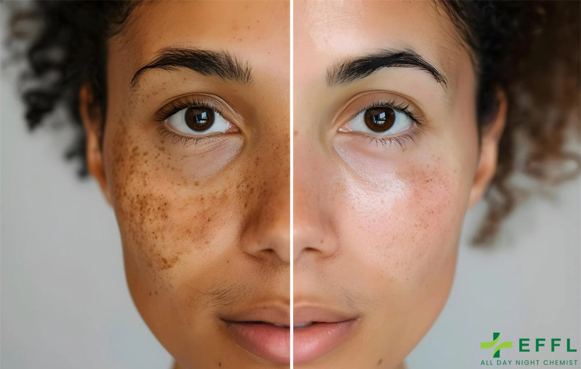 Pigmentation Solutions: What Works, How to Use & Where to Buy