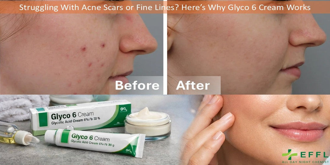 Struggling With Acne Scars or Fine Lines? Here’s Why Glyco 6 Cream Works
